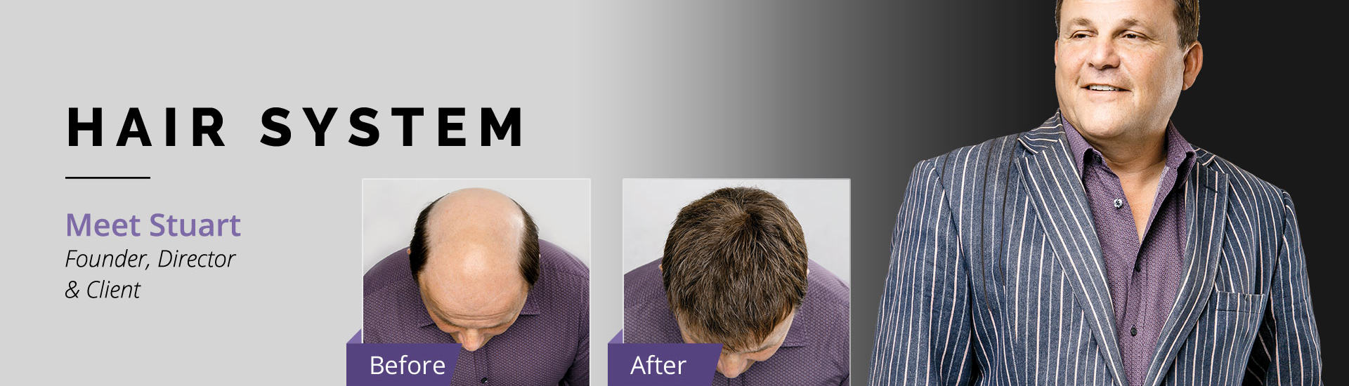 Superior Hair Mens Hair System
